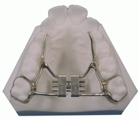 Palatal Expander - Orthodontics in Corpus Christi, TX