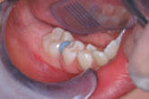 Separator - Orthodontics in Corpus Christi, TX